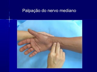 Palpação do nervo mediano
 