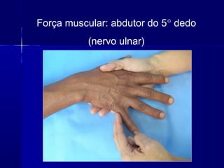 Força muscular: abdutor do 5° dedo
(nervo ulnar)
 