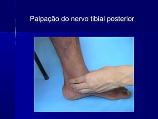 Palpação do nervo tibial posterior
 