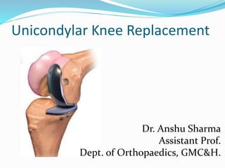 Unicondylar Knee Replacement
Dr. Anshu Sharma
Assistant Prof.
Dept. of Orthopaedics, GMC&H.
 