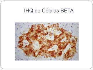 IHQ de Células BETA
 