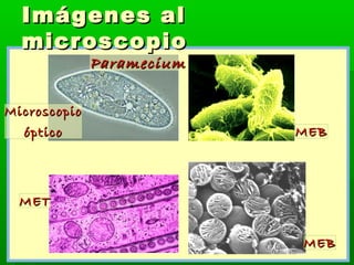 Imágenes al
  micr oscopio
              Paramecium

Microscopio
  óptico                   MEB




  MET


                           MEB
 