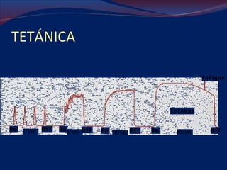 TETÁNICA 