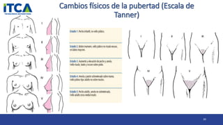 Cambios físicos de la pubertad (Escala de
Tanner)
20
 