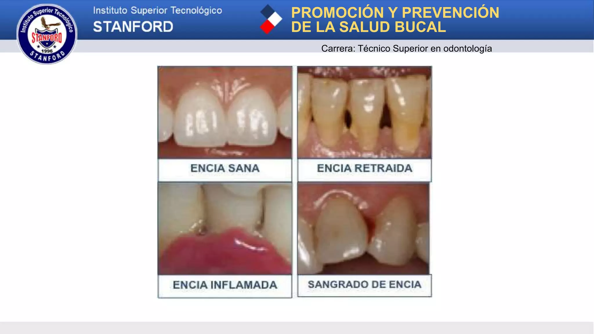 PROMOCIÓN Y PREVENCIÓN
DE LA SALUD BUCAL
Carrera: Técnico Superior en odontología
 