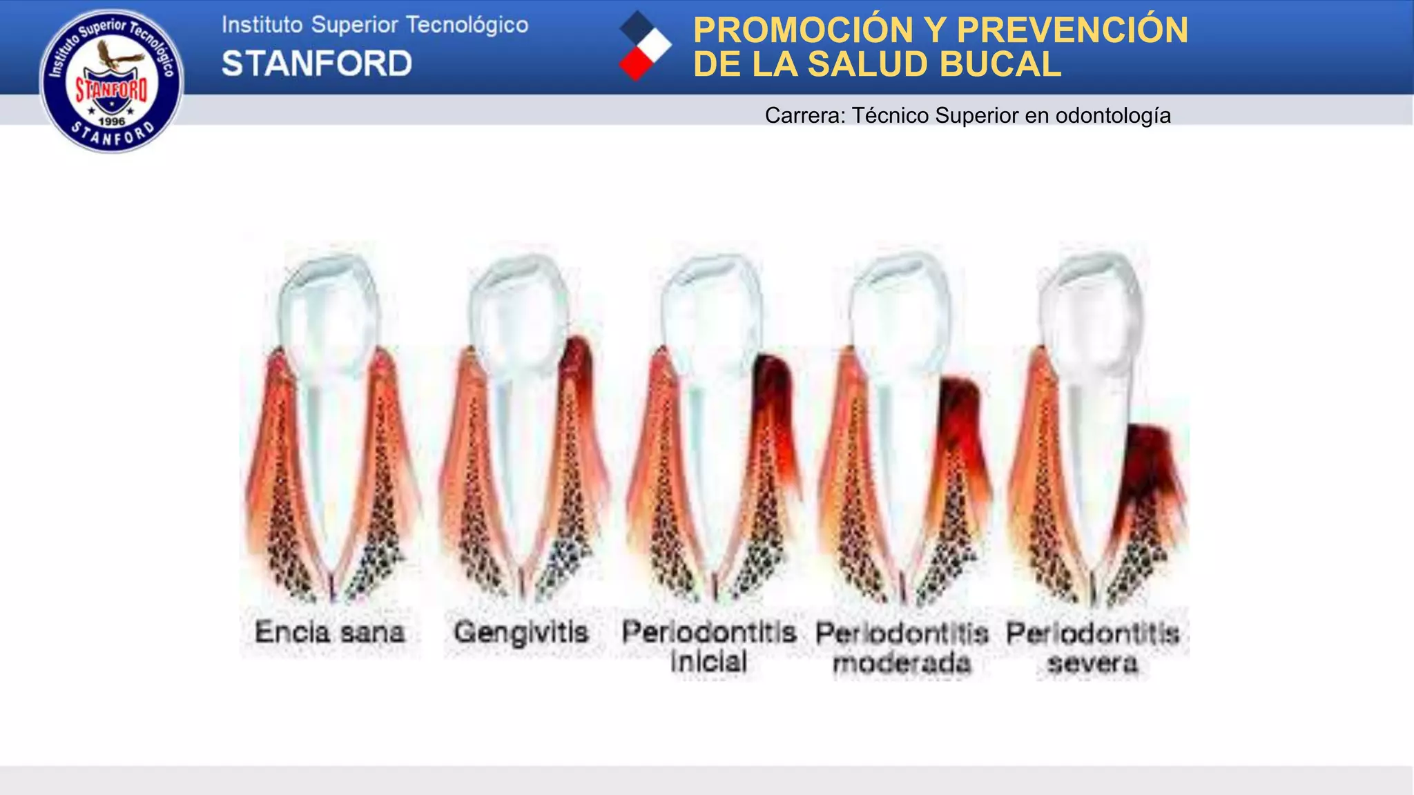 PROMOCIÓN Y PREVENCIÓN
DE LA SALUD BUCAL
Carrera: Técnico Superior en odontología
 
