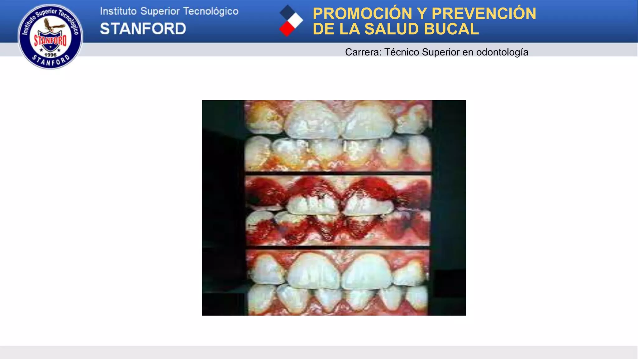 PROMOCIÓN Y PREVENCIÓN
DE LA SALUD BUCAL
Carrera: Técnico Superior en odontología
 