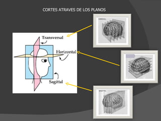 CORTES ATRAVES DE LOS PLANOS Transversal 