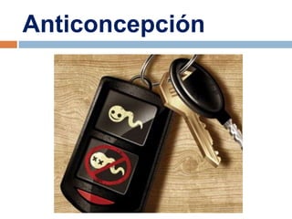 Anticoncepción
 