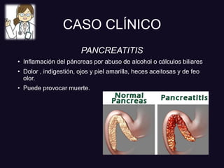 CASO CLÍNICO
PANCREATITIS
• Inflamación del páncreas por abuso de alcohol o cálculos biliares
• Dolor , indigestión, ojos y piel amarilla, heces aceitosas y de feo
olor.
• Puede provocar muerte.
 
