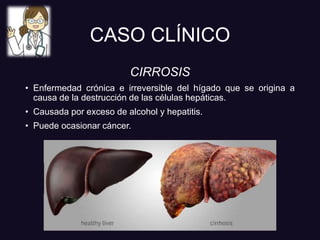 CASO CLÍNICO
CIRROSIS
• Enfermedad crónica e irreversible del hígado que se origina a
causa de la destrucción de las células hepáticas.
• Causada por exceso de alcohol y hepatitis.
• Puede ocasionar cáncer.
 