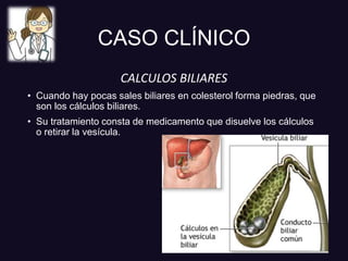 CASO CLÍNICO
CALCULOS BILIARES
• Cuando hay pocas sales biliares en colesterol forma piedras, que
son los cálculos biliares.
• Su tratamiento consta de medicamento que disuelve los cálculos
o retirar la vesícula.
 