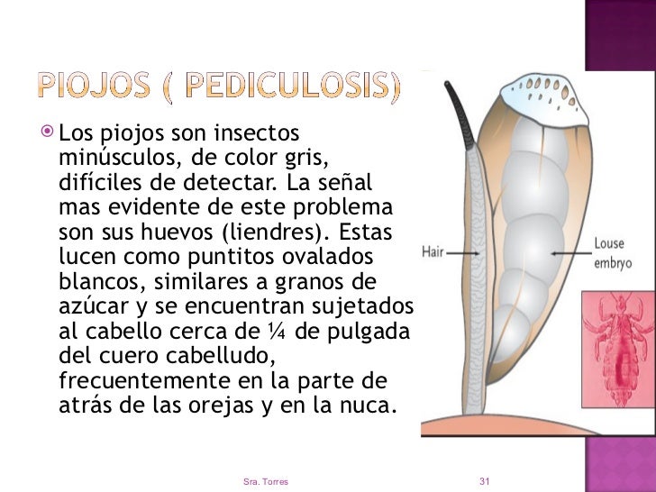 Había de repente unas bolsas en los ojos de la causa