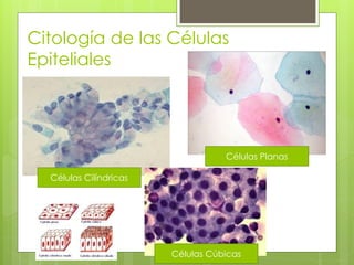 Citología de las Células
Epiteliales




                                   Células Planas

  Células Cilíndricas




                        Células Cúbicas
 