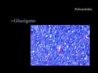 Polisacáridos


–Glucógeno
 
