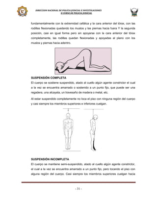 DIRECCION NACIONAL DE POLICIA JUDICIAL E INVESTIGACIONES
II CURSO DE POLICIA JUDICIAL

fundamentalmente con la extremidad cefálica y la cara anterior del tórax, con las
rodillas flexionadas quedando los muslos y las piernas hacia fuera Y la segunda
posición, casi en igual forma pero sin apoyarse con la cara anterior del tórax
completamente, las rodillas quedan flexionadas y apoyadas al plano con los
muslos y piernas hacia adentro.

SUSPENSIÓN COMPLETA
El cuerpo se sostiene suspendido, atado al cuello algún agente constrictor el cual
a la vez se encuentra amarrado o sostenido a un punto fijo, que puede ser una
regadera, una alcayata, un travesaño de madera o metal, etc.
Al estar suspendido completamente no loca el piso con ninguna región del cuerpo
y casi siempre los miembros superiores e inferiores cuelgan.

SUSPENSIÓN INCOMPLETA
El cuerpo se mantiene semi-suspendido, atado al cuello algún agente constrictor,
el cual a la vez se encuentra amarrado a un punto fijo, pero tocando el piso con
alguna región del cuerpo. Casi siempre los miembros superiores cuelgan hacia

- 31 -

 