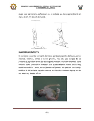 DIRECCION NACIONAL DE POLICIA JUDICIAL E INVESTIGACIONES
II CURSO DE POLICIA JUDICIAL

abajo, pero los inferiores se flexionan por el contacto que tienen generalmente en
el piso o con otro soporte o mueble.

SUMERSIÓN COMPLETA
El cuerpo se encuentra sumergido dentro de grandes recipientes de líquido, como:
albercas, cisternas, piletas o tinacos grandes, ríos, etc. Los cuerpos de las
personas que pierden la vida por asfixia por sumersión adquieren la forma o figura
conocida como "posición de luchador" y se puede observar cuando todavía hay
rigidez cadavérica. Dentro de los grandes recipientes, se aprecian boca abajo,
debido a la ubicación de los pulmones que no obstante conservan algo de aire en
sus alveolos y tienden a flotar.

- 32 -

 