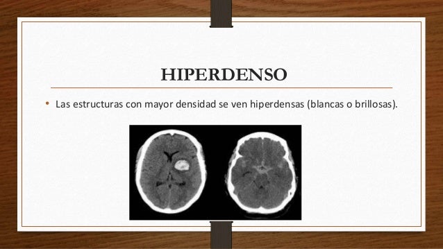 Unidad 3 Terminologia En Tac unidad-3-terminologia-en-tac