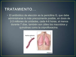 • El antibiótico de elección es la penicilina G, que debe
administrarse lo más precozmente posible, en dosis de
2-3 millones de unidades, cada 4-6 horas, al menos
durante 7 días, también son útiles los macrobios y
quinolinas como la criprofloxacina.
 