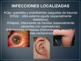 Ojo: queratitis y endoftalmitis (seguidas de trauma)
Oído : otitis externa aguda (especialmente
diabéticos)
Sepsis, infecciones de heridas (especialmente
pacientes con quemaduras)
Erupciones pustulosa (hidromasajes, jacuzzis y
piscinas contaminadas)
INFECCIONES LOCALIZADAS
 