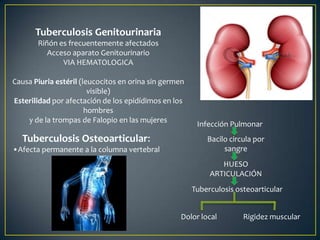 Tuberculosis Genitourinaria
Riñón es frecuentemente afectados
Acceso aparato Genitourinario
VIA HEMATOLOGICA
Causa Piuria estéril (leucocitos en orina sin germen
visible)
Esterilidad por afectación de los epidídimos en los
hombres
y de la trompas de Falopio en las mujeres
Tuberculosis Osteoarticular:
•Afecta permanente a la columna vertebral
Infección Pulmonar
Bacilo circula por
sangre
HUESO
ARTICULACIÓN
Tuberculosis osteoarticular
Dolor local Rigidez muscular
 