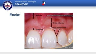 Encía: también denominada gingiva; recubre la
parte exterior del hueso alveolar y está unida
directamente con el diente. Es el tejido
conectivo fibroso que está alrededor del cuello
de los dientes y cubre el hueso alveolar. Su
función principal es la de soportar y mantener los
dientes en su sitio.
PARTES DEL PERIODONTO
 