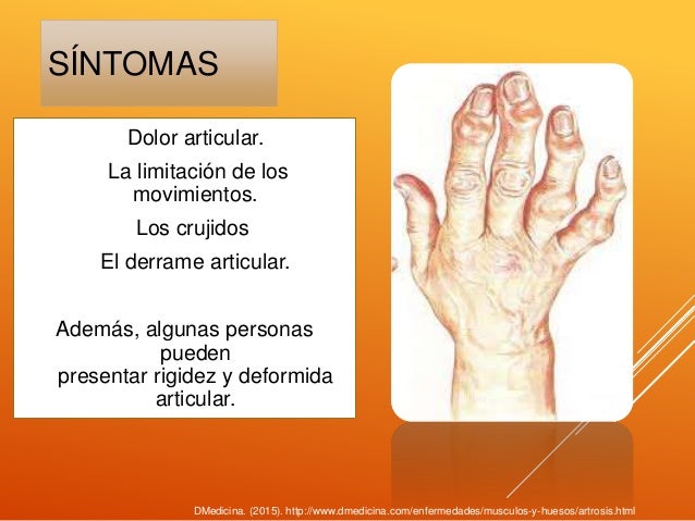 Alteraciones más frecuentes del sistema musculoesqueletico