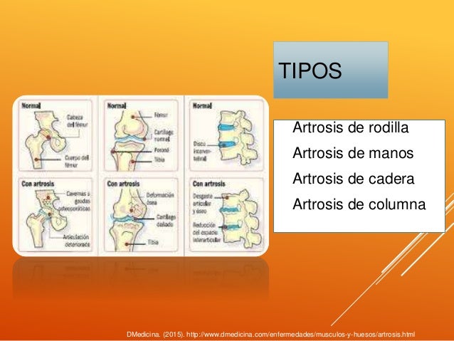 Alteraciones más frecuentes del sistema musculoesqueletico