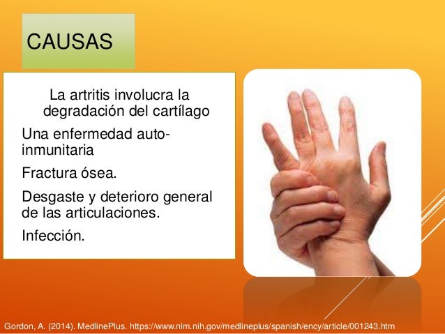 Alteraciones más frecuentes del sistema musculoesqueletico