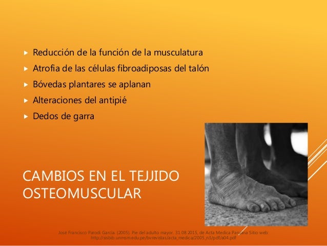 Alteraciones más frecuentes del sistema musculoesqueletico