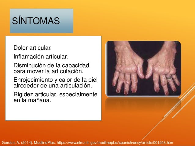Alteraciones más frecuentes del sistema musculoesqueletico