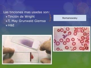 Las tinciones mas usadas son:
  Tinción de Wright
                                Romanowsky
  T. May Grunwald Giemsa
  H&E
 