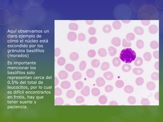 Aquí observamos un
claro ejemplo de
cómo el núcleo está
escondido por los
gránulos basófilos
(morados)
Es importante
mencionar los
basófilos solo
representan cerca del
0.5% del total de
leucocitos, por lo cual
es difícil encontrarlos
en frotis, hay que
tener suerte y
paciencia.
 