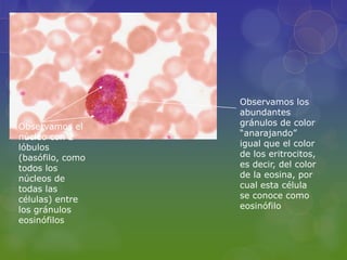 Observamos los
                  abundantes
Observamos el     gránulos de color
núcleo con 2      “anarajando”
lóbulos           igual que el color
(basófilo, como   de los eritrocitos,
todos los         es decir, del color
núcleos de        de la eosina, por
todas las         cual esta célula
células) entre    se conoce como
los gránulos      eosinófilo
eosinófilos
 