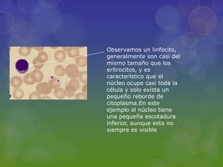 Observamos un linfocito,
generalmente son casi del
mismo tamaño que los
eritrocitos, y es
característico que el
núcleo ocupe casi toda la
célula y solo exista un
pequeño reborde de
citoplasma.En este
ejemplo el núcleo tiene
una pequeña escotadura
inferior, aunque esta no
siempre es visible
 