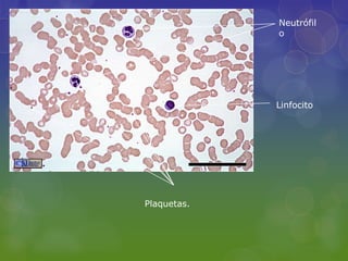 Neutrófil
             o




             Linfocito




Plaquetas.
 