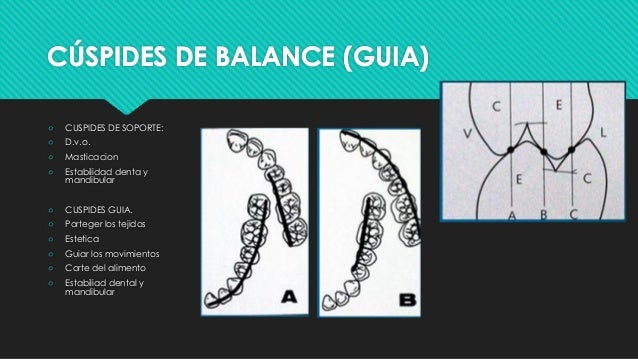 Cuspides De Trabajo Y De Balance