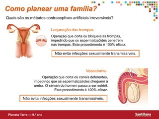 Como planear uma família?
Quais são os métodos contraceptivos artificiais irreversíveis?


                            Laqueação das trompas
                            Operação que corta ou bloqueia as trompas,
                            impedindo que os espermatozóides penetrem
                            nas trompas. Este procedimento é 100% eficaz.

                              Não evita infecções sexualmente transmissíveis.



                                                 Vasectomia
                       Operação que corta os canais deferentes,
                  impedindo que os espermatozóides cheguem à
                  uretra. O sémen do homem passa a ser estéril.
                               Este procedimento é 100% eficaz.

          Não evita infecções sexualmente transmissíveis.



 Planeta Terra — 9.º ano
 