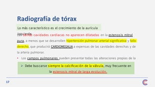 17
Lo más caracterís tico es el crecimiento de la aurícula
izquierda.
Radiografía de tórax
Las demás cavidades cardiacas no aparecen dilatadas en la estenosis mitral
pura, a menos que se desarrollen hipertensión pulmonar arterial significativa y fallo
derecho, que producirá CARDIOMEGALIA a expensas de las cavidades derechas y de
la arteria pulmonar.
• Los campos pulmonares pueden presentar todas las alteraciones propias de la
congestión pulmonar.
➢ Debe buscars e siempre la calcificación de la válvula, muy frecuente en
la es tenos is mitral de larga evolución.
 