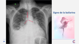 18
Signo de la bailarina
 