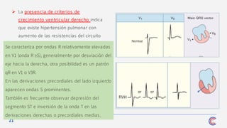 21
➢ La pres encia de criterios de
crecimiento ventricular derecho indica
que existe hipertensión pulmonar con
aumento de las resistencias del circuito
menor.
Se caracteriza por ondas R relativamente elevadas
en V1 (onda R ≥S), generalmente por desviación del
eje hacia la derecha, otra posibilidad es un patrón
qR en V1 o V3R.
En las derivaciones precordiales del lado izquierdo
aparecen ondas S prominentes.
También es frecuente observar depresión del
segmento ST e inversión de la onda T en las
derivaciones derechas o precordiales medias.
 