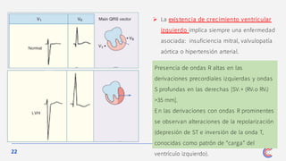 22
➢ La existencia de crecimiento ventricular
izquierdo implica siempre una enfermedad
asociada: insuficiencia mitral, valvulopatía
aórtica o hipertensión arterial.
Presencia de ondas R altas en las
derivaciones precordiales izquierdas y ondas
S profundas en las derechas [SV1 + (RV5 o RV6)
>35 mm].
En las derivaciones con ondas R prominentes
se observan alteraciones de la repolarización
(depresión de ST e inversión de la onda T,
conocidas como patrón de “carga” del
ventrículo izquierdo).
 
