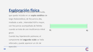 34
Exploración física
Un primer ruido de intensidad disminuida,
que queda incluido en un soplo sistólico de
largo (holosistólico), de frecuencia alta,
irradiado a axila , intensidad III/VI o mayor,
con frecuencia acompañado de frémito
cuando se trata de una insuficiencia mitral
grave.
Cuando hay hipertensión pulmonar, el
componente del segundo ruido se halla
reforzado y puede aparecer un clic de
eyección.
R1 R2
 