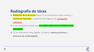 35
Radiografía de tórax
❖ Dilatación de la aurícula (mayor en la insuficiencia mitral crónica) y
ventrículo izquierdo, y aparición de imágenes de congestión
pulmonar.
❖ En la insuficiencia mitral pura no suelen observars e calcificaciones
valvulares .
❖ En la insuficiencia mitral aguda, se observa edema pulmonar y
ausencia de cardiomegalia.
 