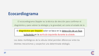 37
Ecocardiograma
Los datos morfológicos de la válvula mitral permiten diferenciar entre los
distintos mecanismos y sospechar una determinada etiología.
El ecocardiograma Doppler es la técnica de elección para confirmar el
diagnóstico y para valorar la etiología y la gravedad, así como el estado de la
función ventricular.
El diagnós tico por Doppler color se bas a en la detección de un flujo
turbulento en la aurícula izquierda durante la sístole.
 