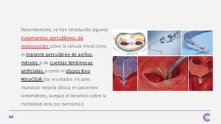 44
Recientemente, se han introducido algunos
tratamientos percutáneos de
intervención sobre la válvula mitral como
el implante percutáneo de anillos
mitrales o de cuerdas tendinos as
artificiales o como el dispositivo
MitraClipR (los resultados iniciales
muestran mejoría clínica en pacientes
sintomáticos, aunque el beneficio sobre la
mortalidad esta por demostrar).
 
