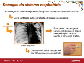 As doenças do sistema respiratório têm grande impacto no sistema circulat ório . A má ventilação pulmonar afecta o transporte de oxigénio. É um tumor que, em geral, surge nos brônquios e depois se espalha pelo resto do pulmão e por outros órgãos. O hábito de fumar é responsável por 90% dos cancros do pulmão. Doenças do sistema respiratório Planeta Terra — 9.º ano por exemplo Cancro do pulmão 