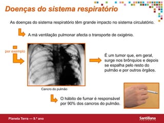 As doenças do sistema respiratório têm grande impacto no sistema circulatório.
A má ventilação pulmonar afecta o transporte de oxigénio.
por exemplo
É um tumor que, em geral,
surge nos brônquios e depois
se espalha pelo resto do
pulmão e por outros órgãos.
O hábito de fumar é responsável
por 90% dos cancros do pulmão.
Doenças do sistema respiratório
Planeta Terra — 9.º ano
Cancro do pulmão
 