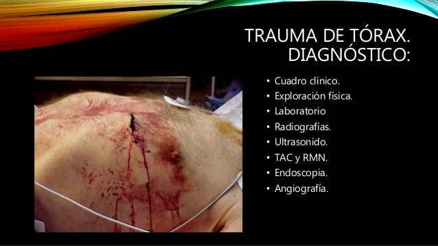 Traumatismo toracico abdominal