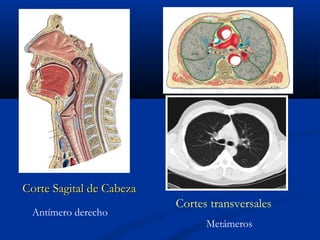 Corte Sagital de CabezaCorte Sagital de Cabeza
Antímero derecho
Cortes transversales
Metámeros
 
